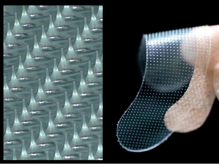 11月12日。京都発ベンチャー企業が発想の転換で生みだしたマイクロニードルが、世界に新市場を創出した日。